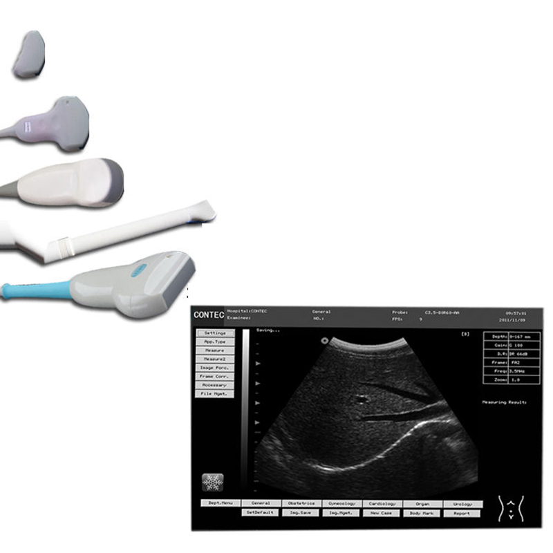 Système de diagnostic par ultrasons vétérinaire CMS600P2VET