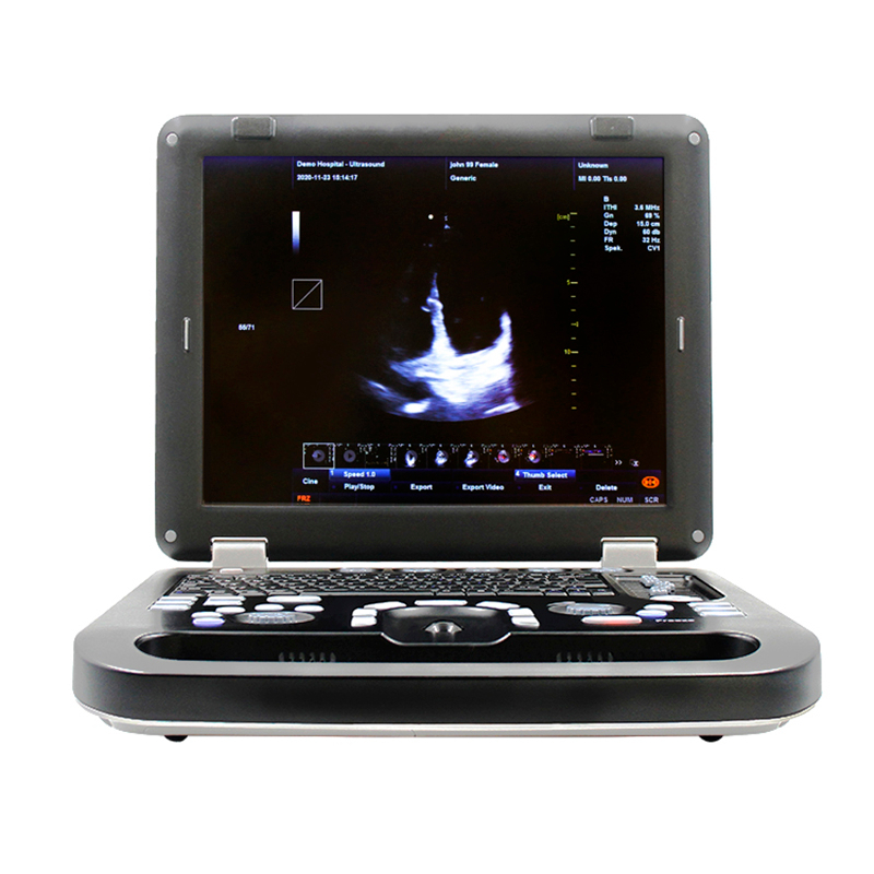 Équipement d'échographie vétérinaire portable CMS1700C-VET