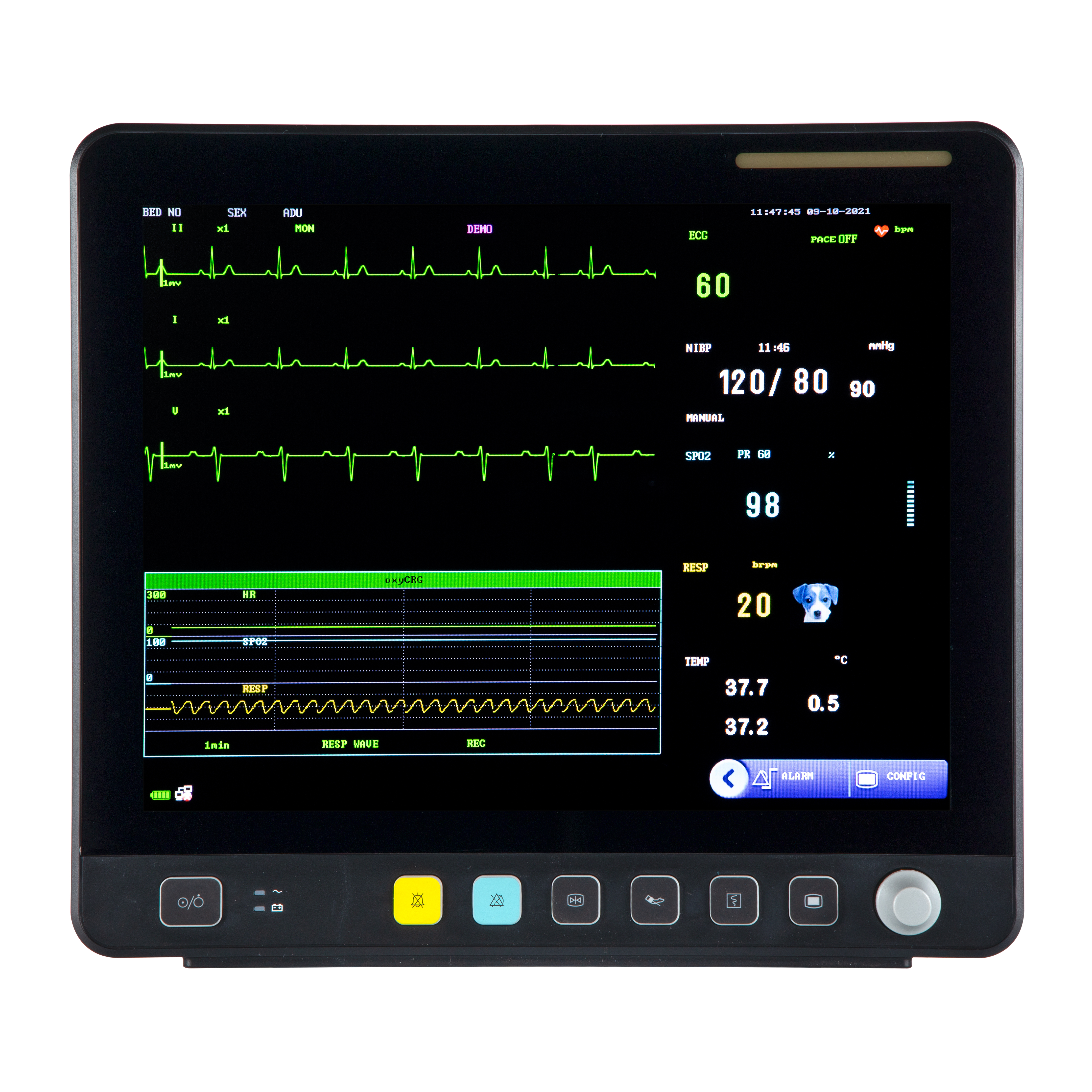 Moniteur ECG multiparamétrique vétérinaire à écran tactile VE15