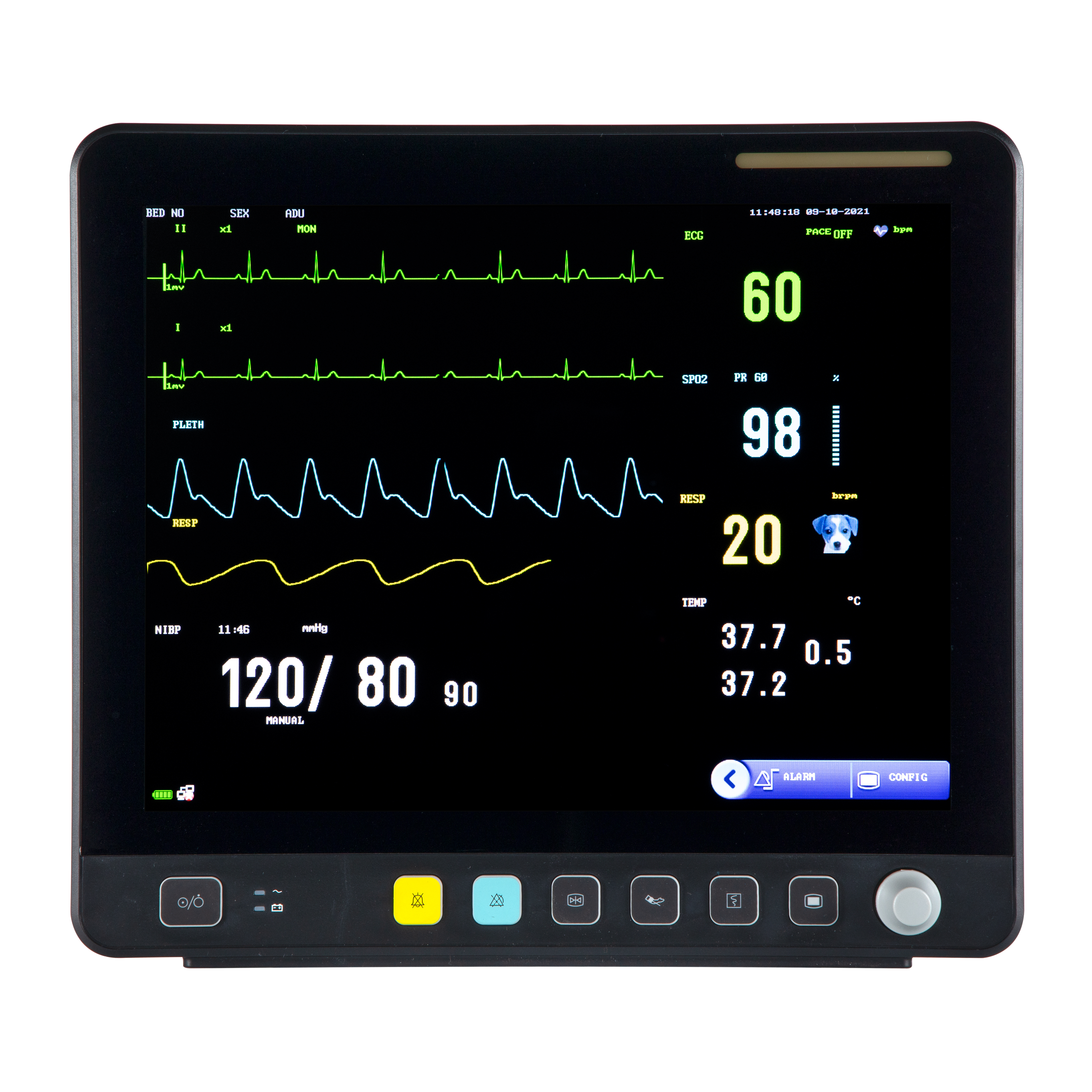 Moniteur ECG multiparamétrique vétérinaire à écran tactile VE15